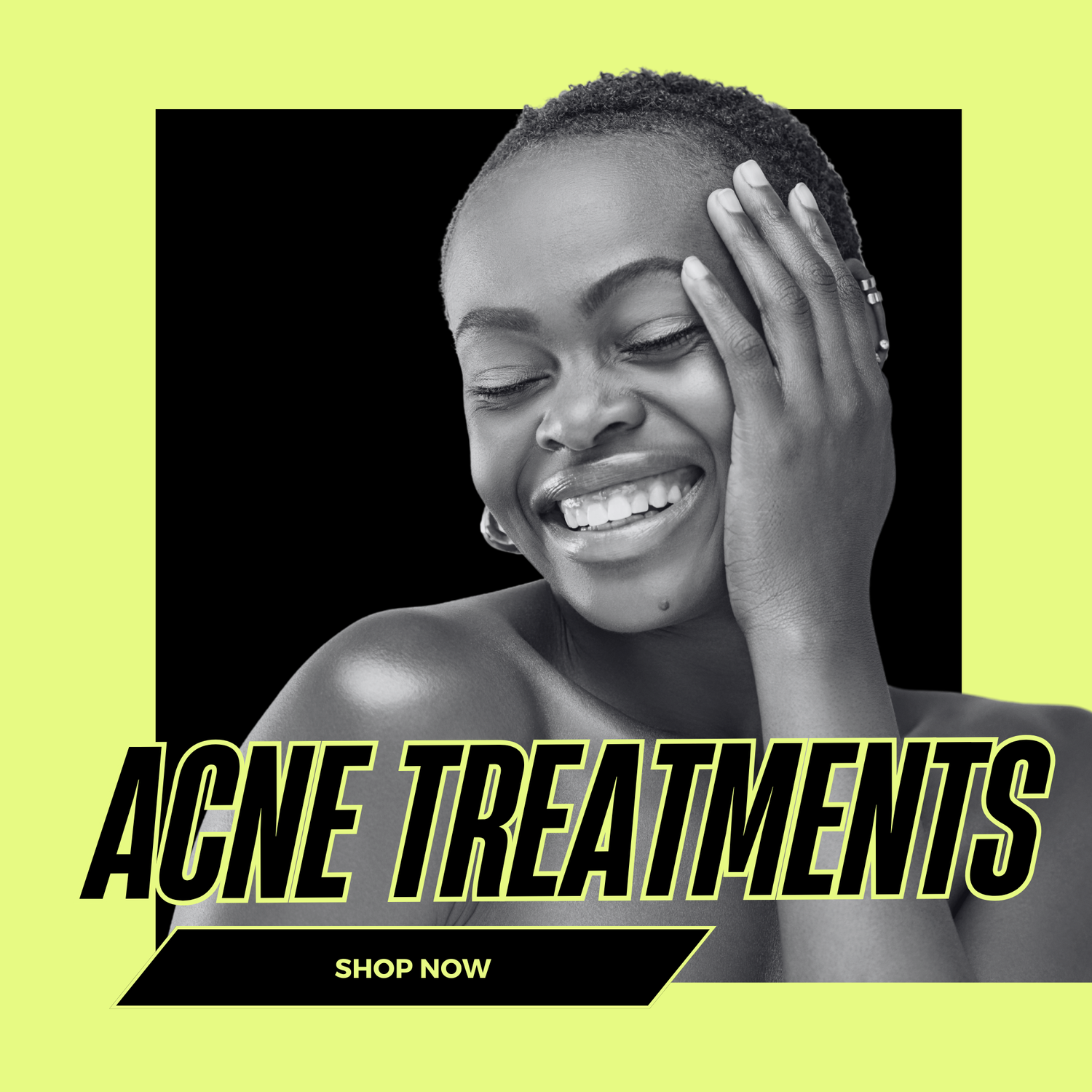 Acne Treatments